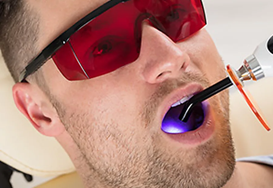 Composite filling material being hardened with a curing light.